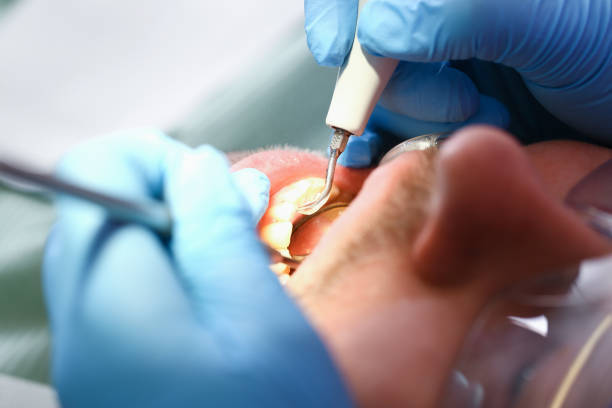 Best Broken or Cracked Tooth Emergency Dentist in Red Bud, IL