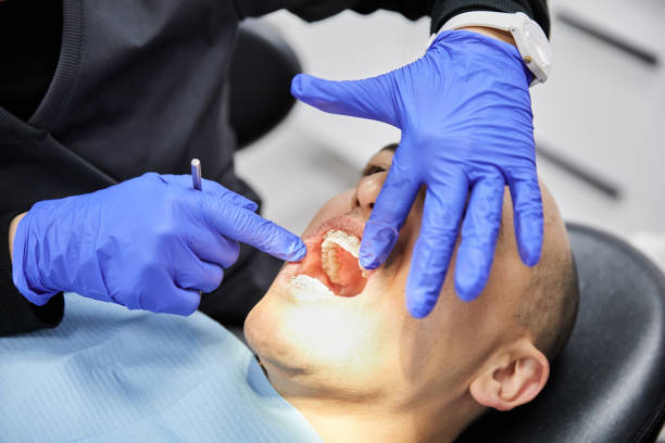 Best Emergency Dental Extractions in Red Bud, IL