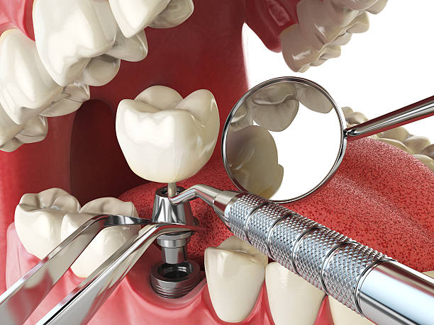 Best Emergency Cosmetic Dentistry in Red Bud, IL